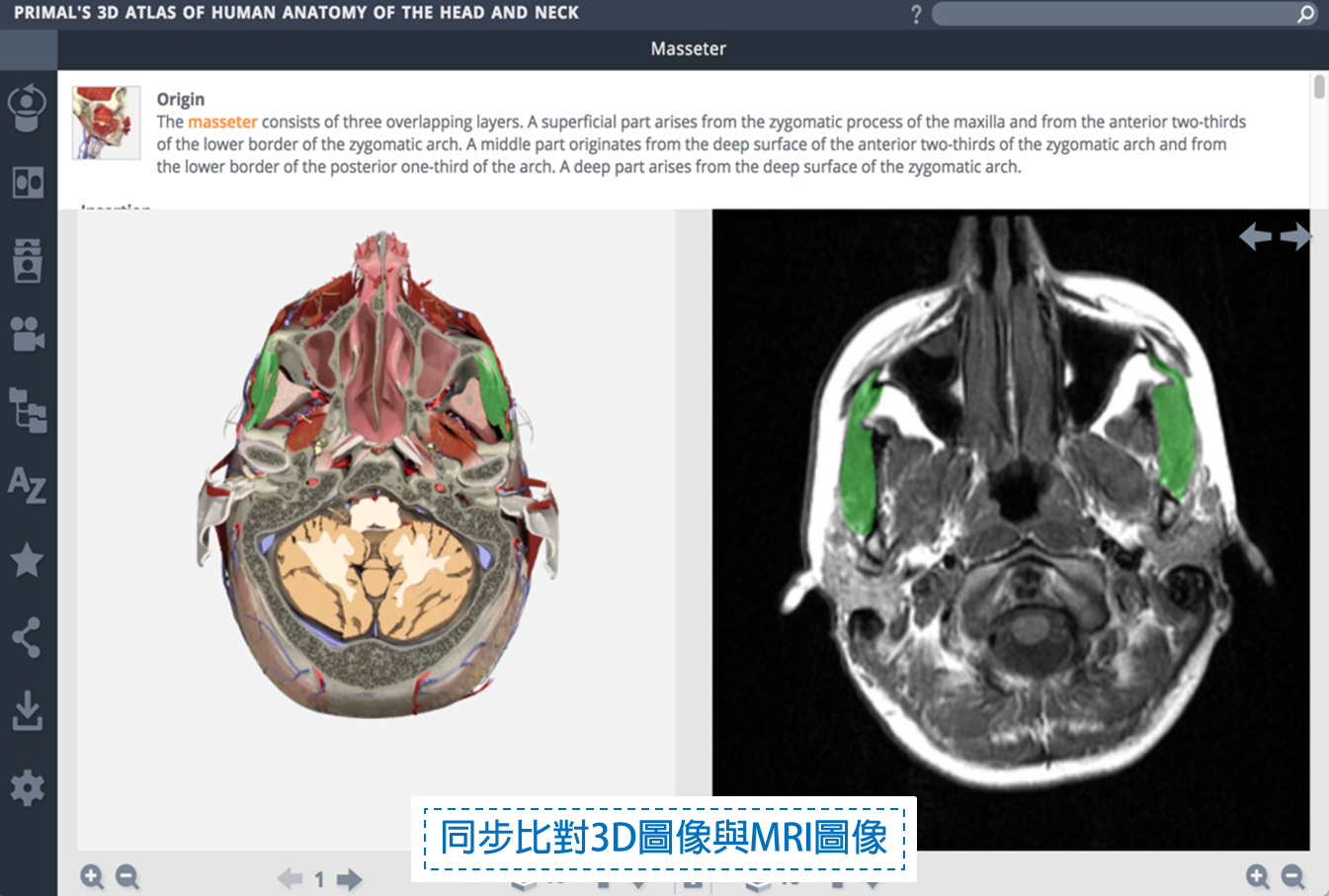Primal Pictures Anatomy資料庫-同步比對3D圖像與MRI圖像
